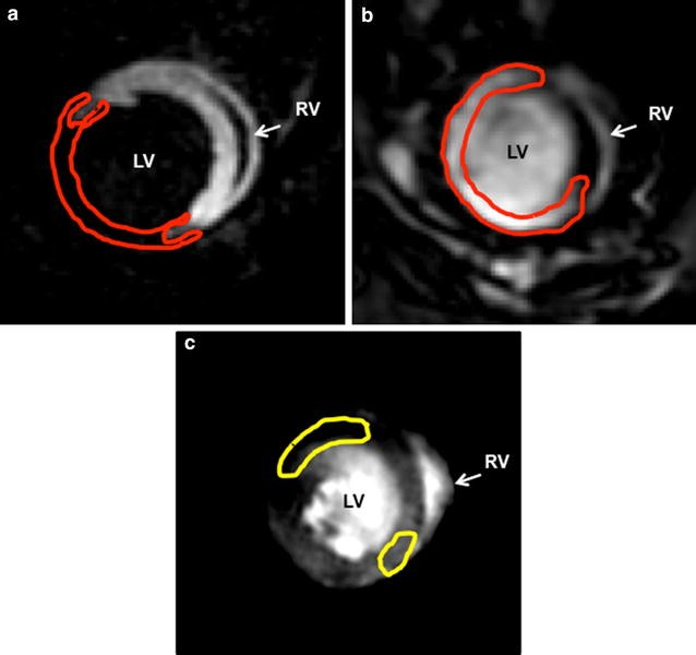 Fig. 3