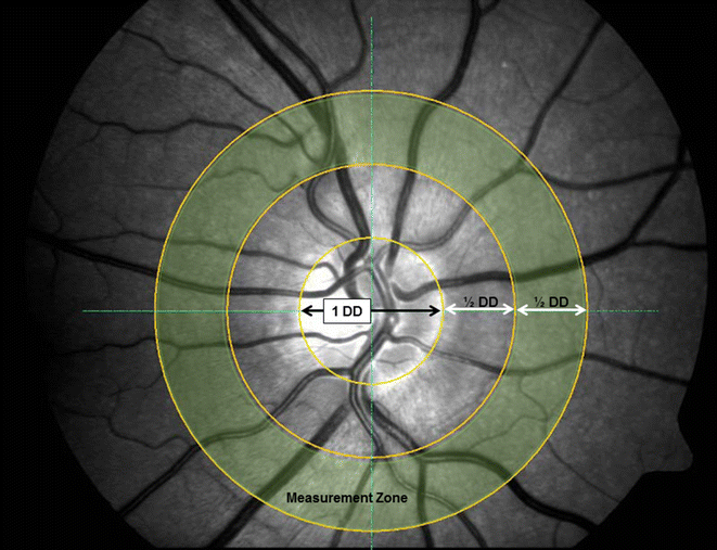 Fig. 1