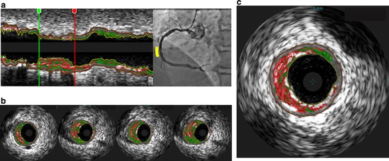 Fig. 2