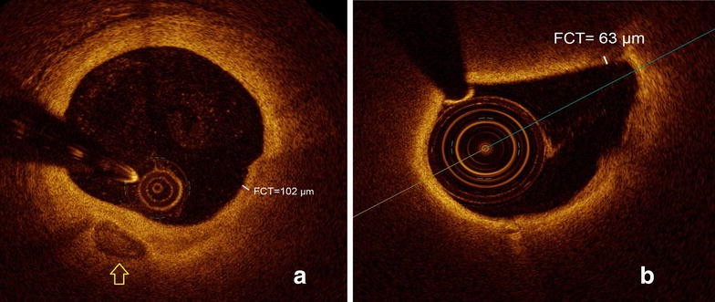 Fig. 3