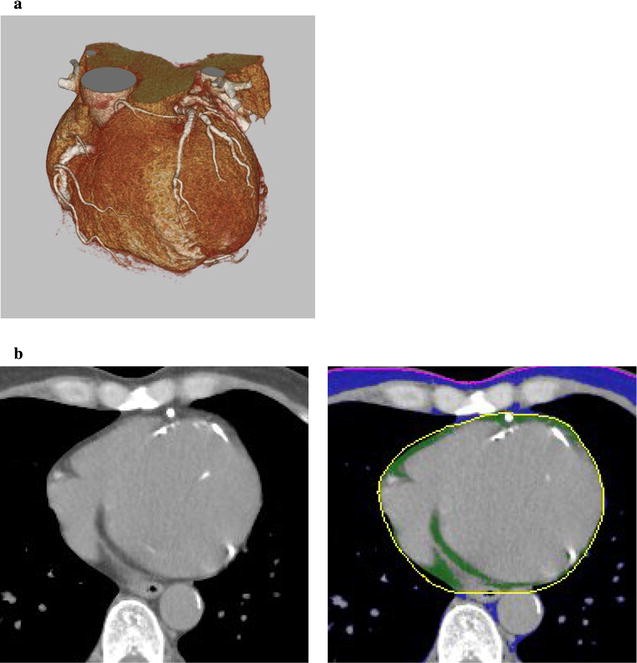 Fig. 1