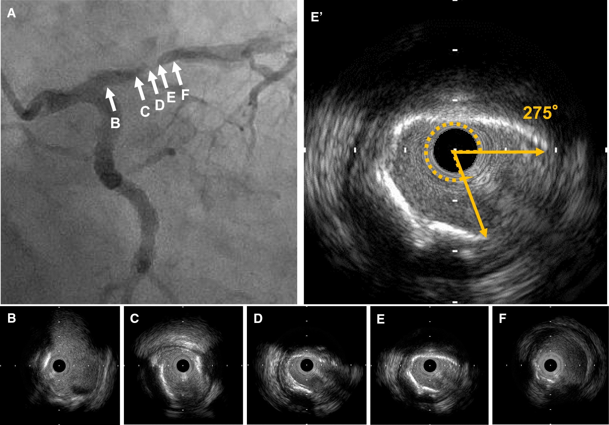 Fig. 2