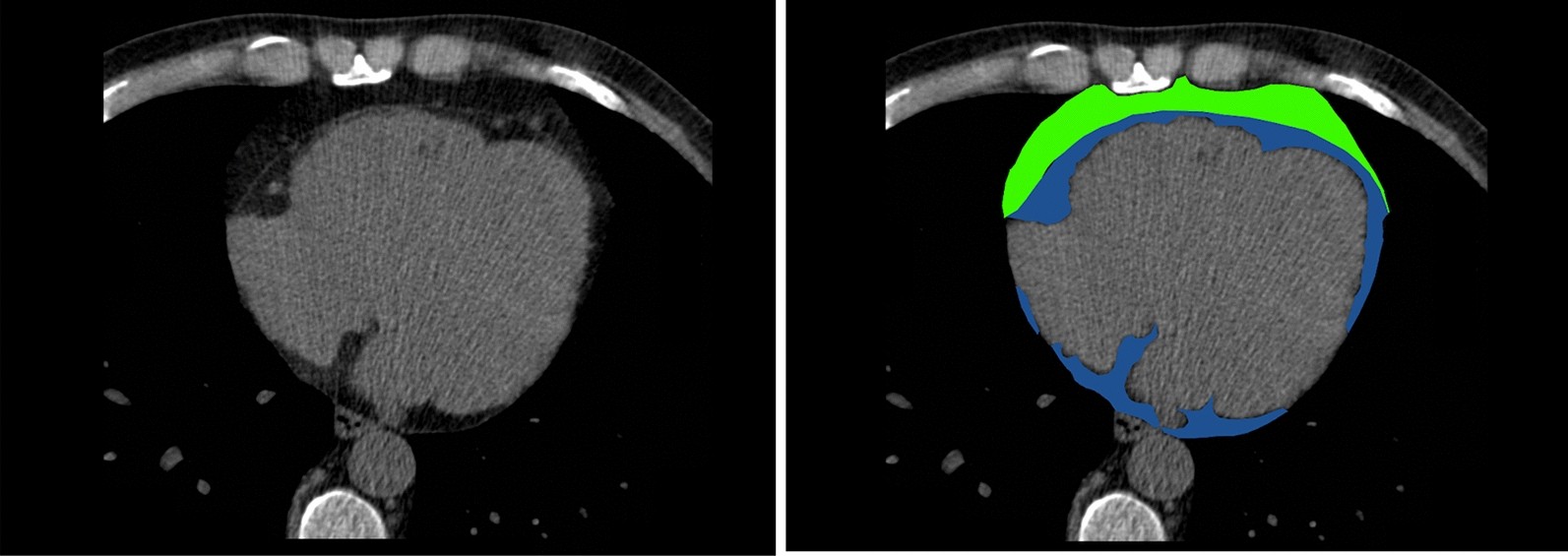 Fig. 2