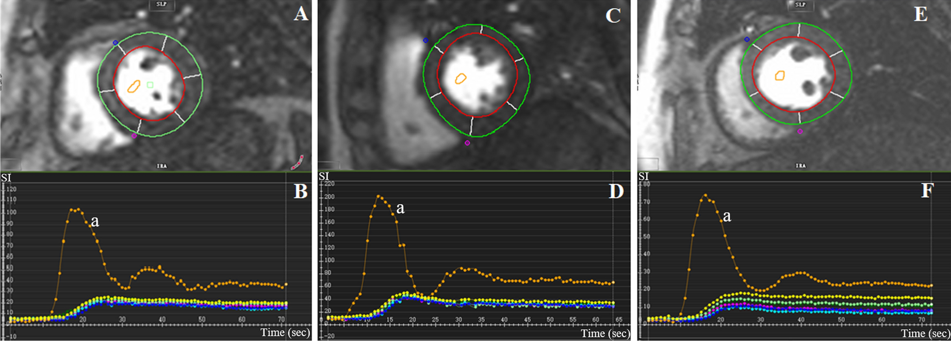 Fig. 2