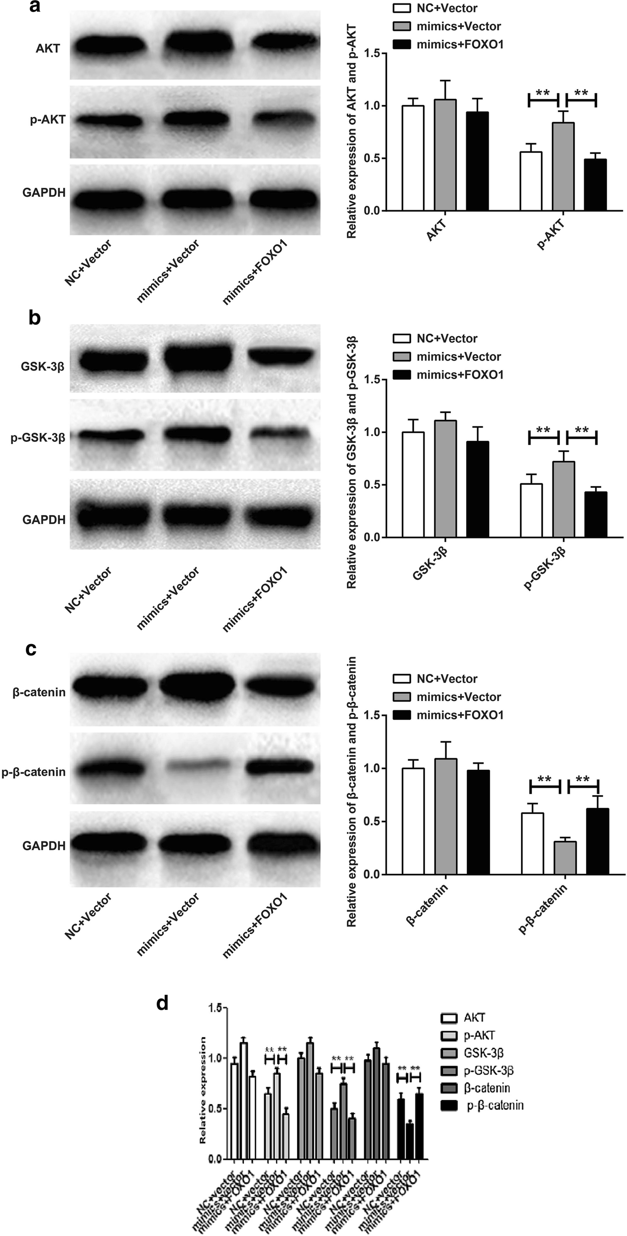 Mir 96 Exerts Carcinogenic Effect By Activating Akt Gsk 3b B Catenin Signaling Pathway Through Targeting Inhibition Of Foxo1 In Hepatocellular Carcinoma Cancer Cell International Full Text