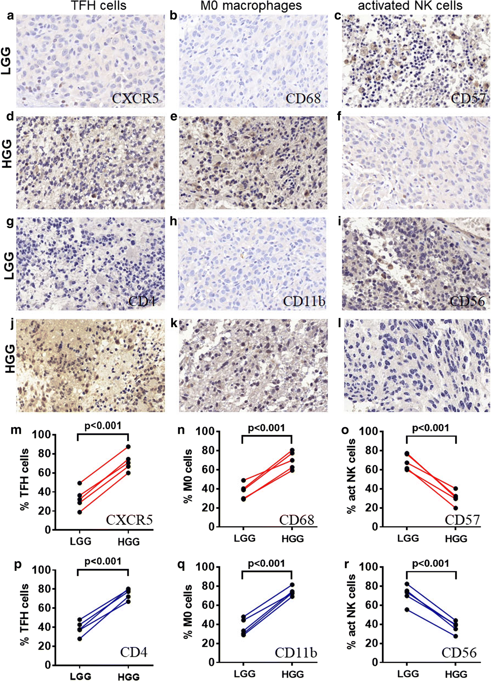 Identification Of 3 Subpopulations Of Tumor Infiltrating Immune Cells For Malignant Transformation Of Low Grade Glioma Cancer Cell International Full Text Identification Of 3 Subpopulations Of Tumor Infiltrating Immune Cells For Malignant Transformation Of Low Grade Glioma Cancer Cell International Full Text
