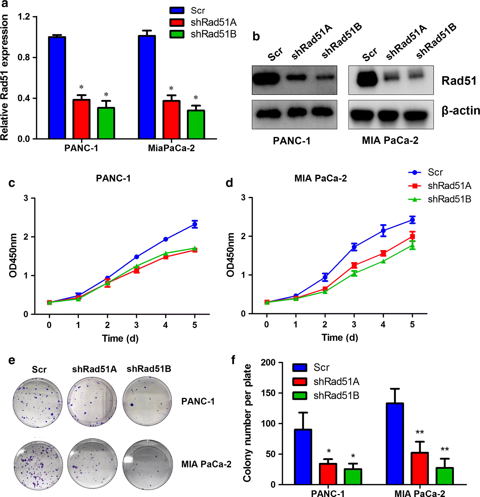 RAD51 is a potential marker for prognosis and regulates cell proliferation  in pancreatic cancer | Cancer Cell International | Full Text
