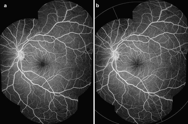 Fig. 1