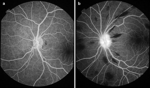 Fig. 27