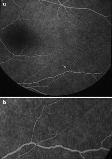 Fig. 29