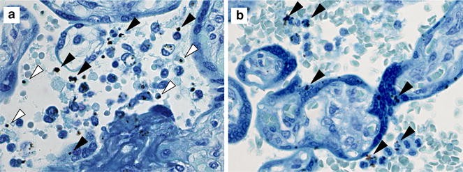 Fig. 1