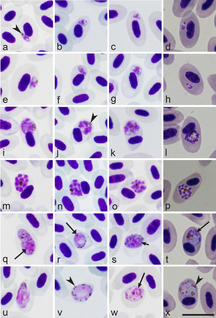 Figure 3 Characterization Of Plasmodium Relictum A Cosmopolitan Agent Of Avian Malaria Springerlink