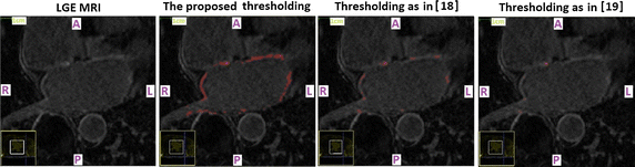 Fig. 6