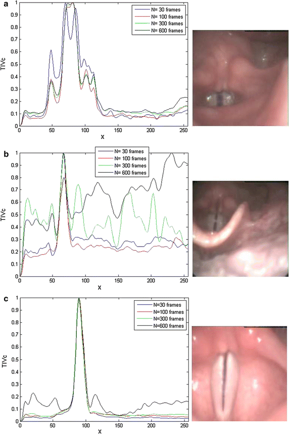 Fig. 12