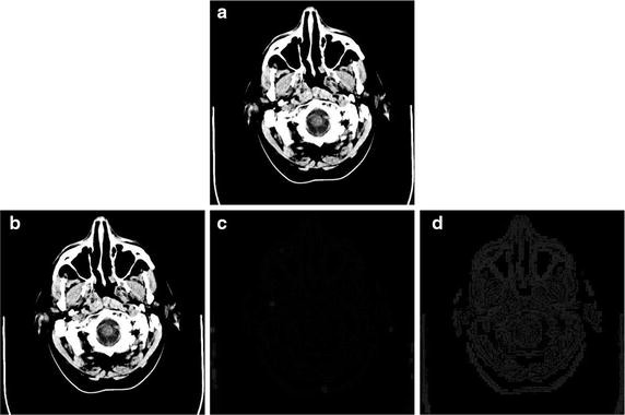 Fig. 1