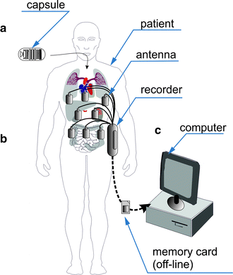 Fig. 2