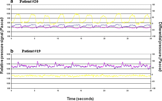 Fig. 4