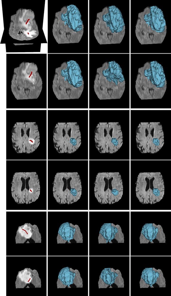 Fig. 10