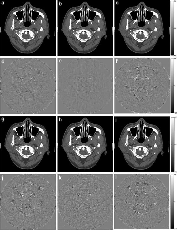 Fig. 12