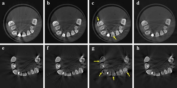 Fig. 11