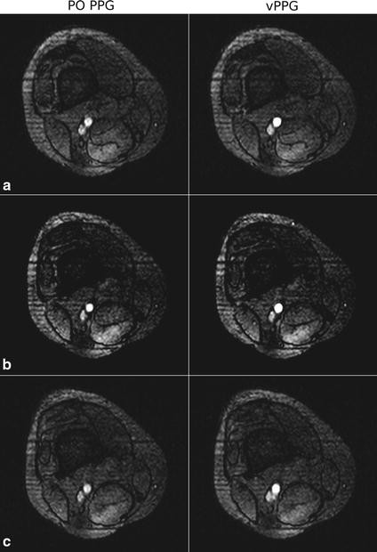 Fig. 13