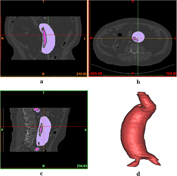 Fig. 2