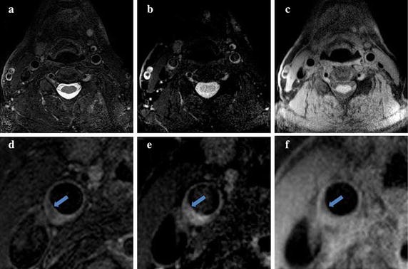 Fig. 4