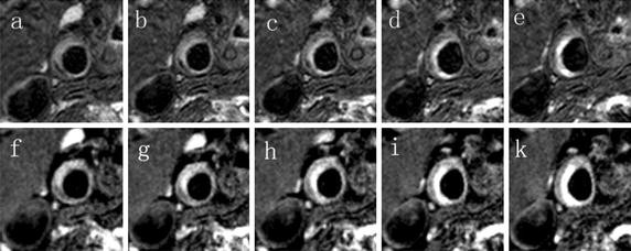 Fig. 5