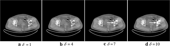 Fig. 11