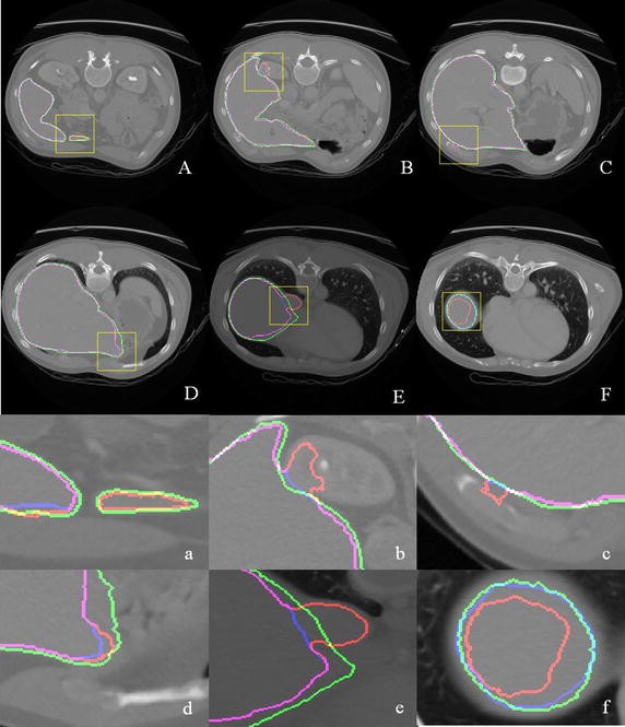 Fig. 6