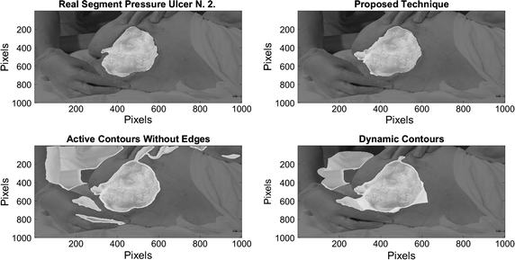 Fig. 13