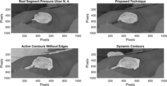 Fig. 15