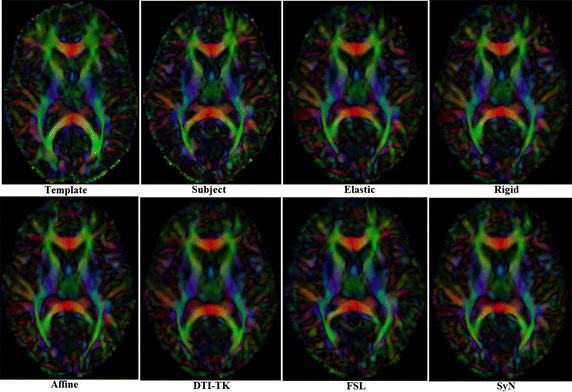 Fig. 1