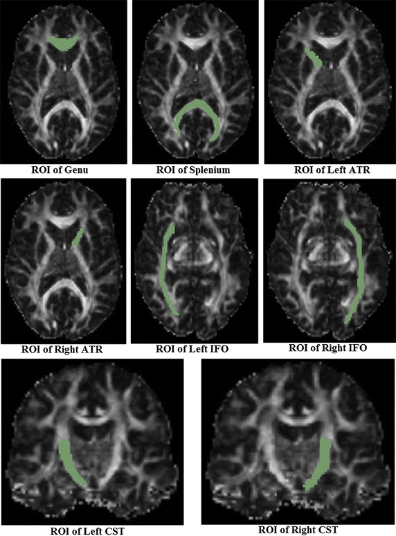 Fig. 2