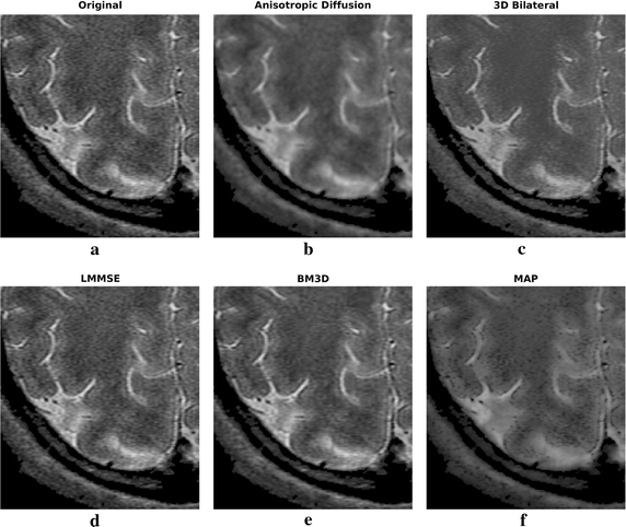 Fig. 10