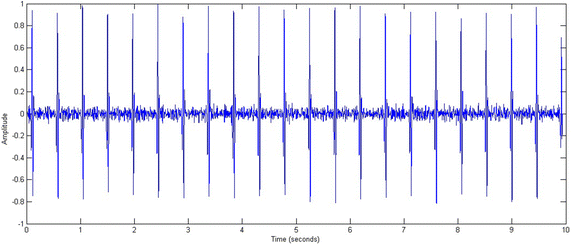 Fig. 11