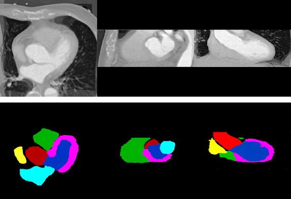 Fig. 2