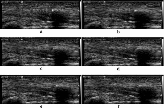 Fig. 15