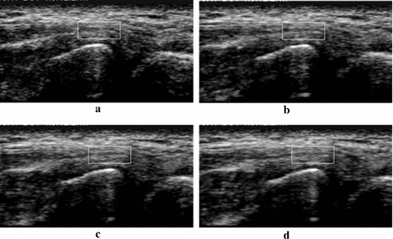 Fig. 16