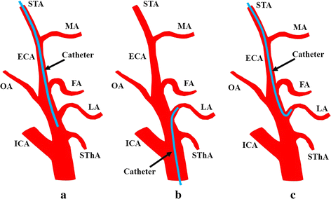 Fig. 1