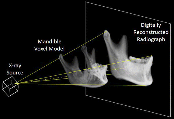 Fig. 1