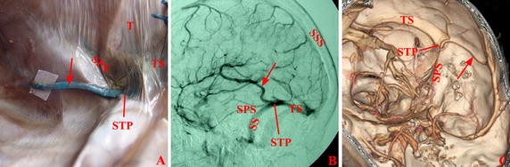 Fig. 4