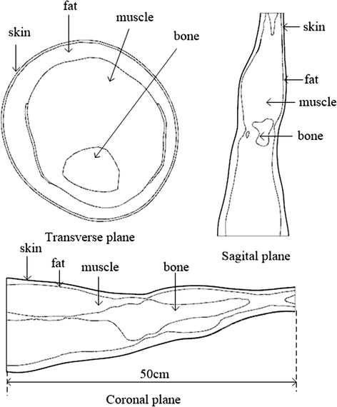 Fig. 1