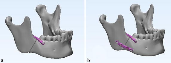 Fig. 5