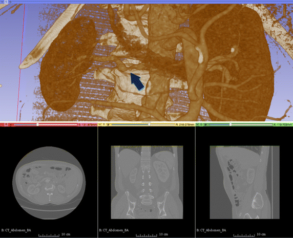 Fig. 2