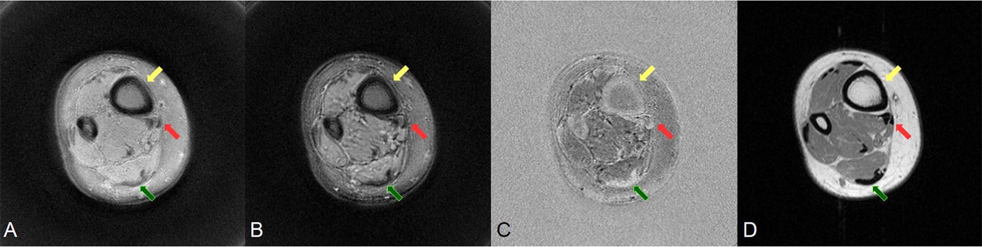 Fig. 4