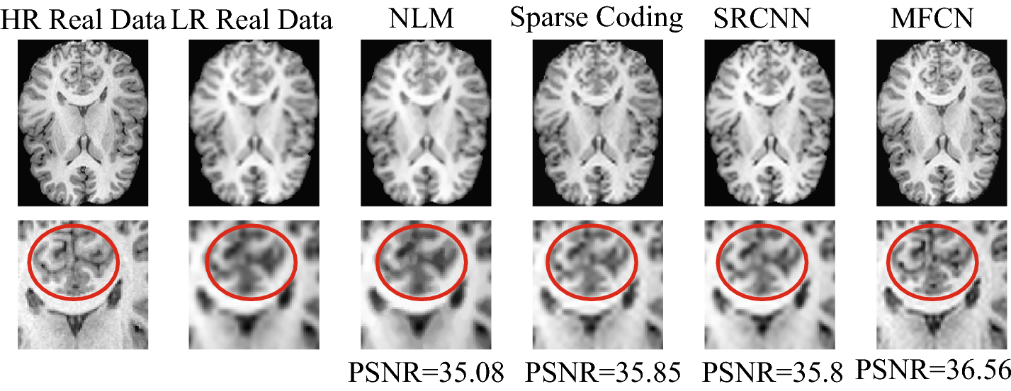 Fig. 18