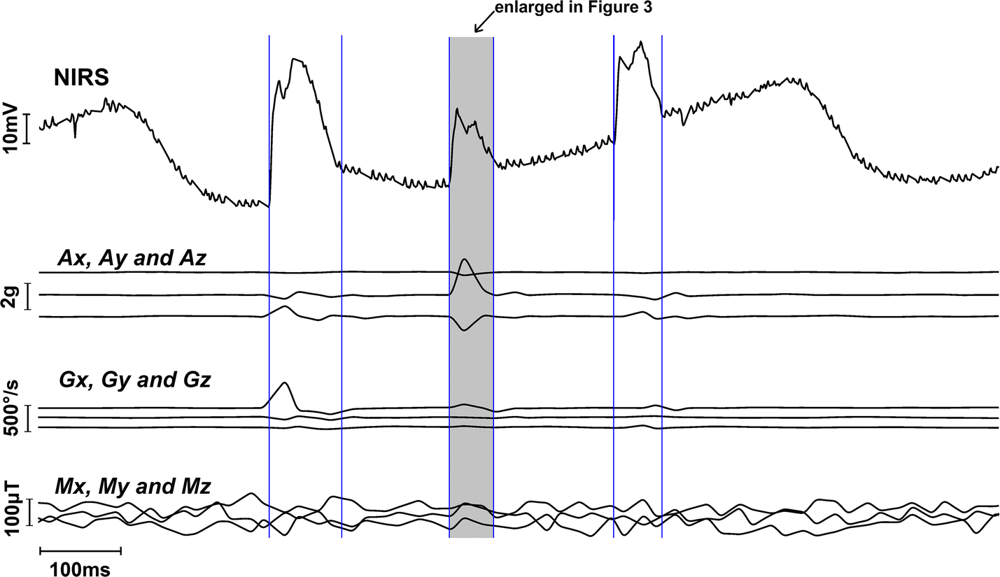 Fig. 2