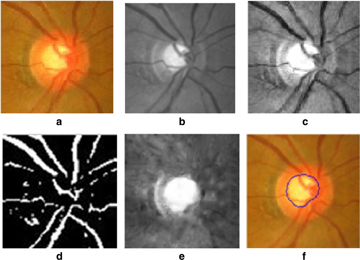 Fig. 3