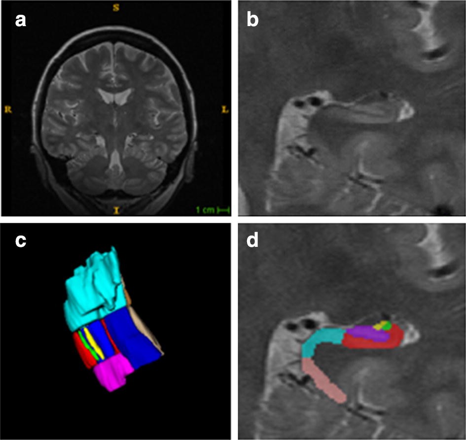 Fig. 1